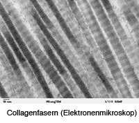 Collagenfasern unter dem Elektronenmikropkop